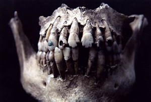 Modified teeth found at the site of Ixtontón. Image via Mesoweb